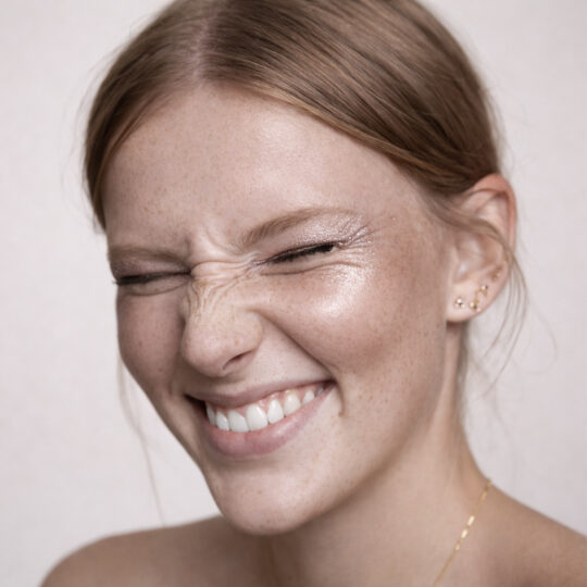 Botox Nasal · Armonización de la Punta Nasal